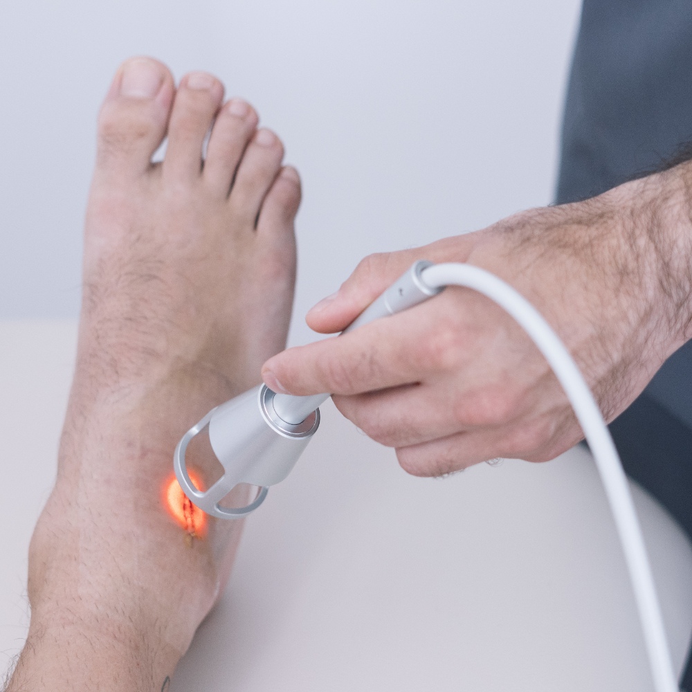 Laser Therapy for Foot Pain 