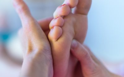 Hallux Varus: Keep Your Big Toe From Drifting Away