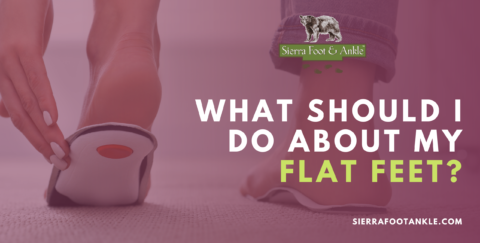 What Should I Do About My Flat Feet? | Sierra Foot & Ankle